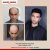 FUE Hair Transplant in Lahore