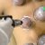 dry cupping hijama