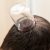 Hijama on head