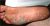images (1)