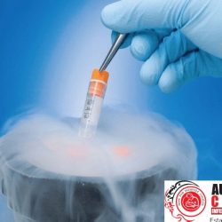 Frozen Embryo Transfer (FET)