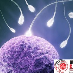 Azoospermia Treatment