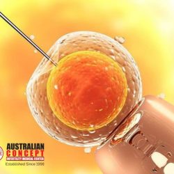new ivf Images