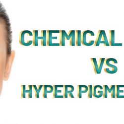 Chemical-peels-vs-Acne-and-Hyperpigmentation