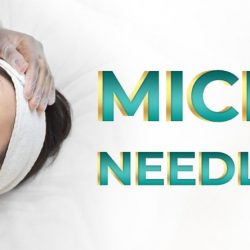 Microneedling