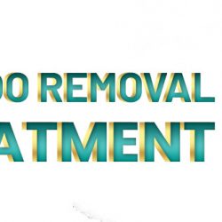 Tattoo-Removal-Treatment-in-Islamabad