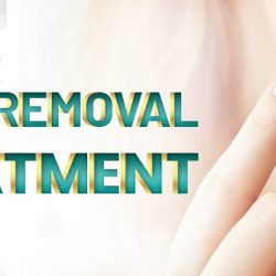 Mole-Removal-Treatment-in-Islamabad-thumbnail