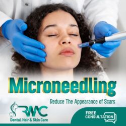 Microneedling Therapy in Islamabad - Best Microneedling Treatment in Islamabad - Microneedling Treatment in Islamabad - RMC-1